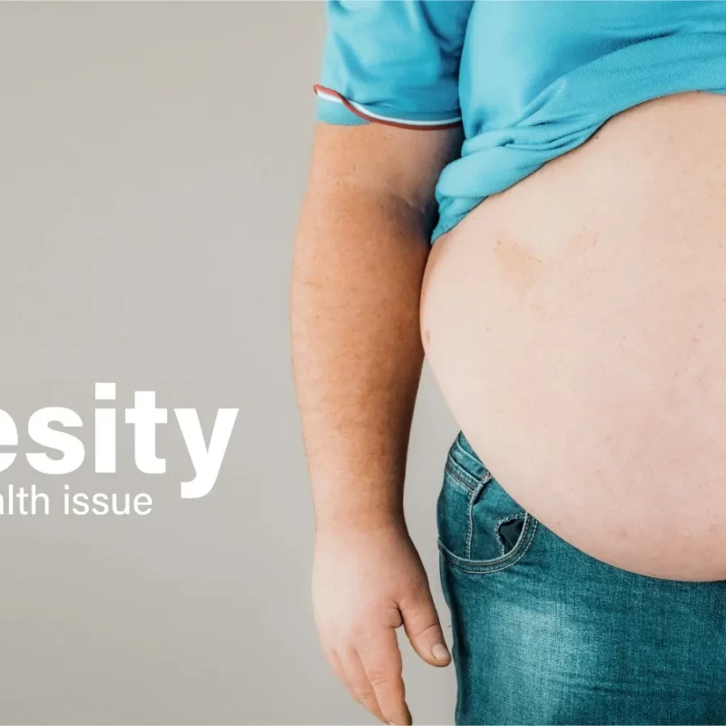 Is obesity a challenge ?